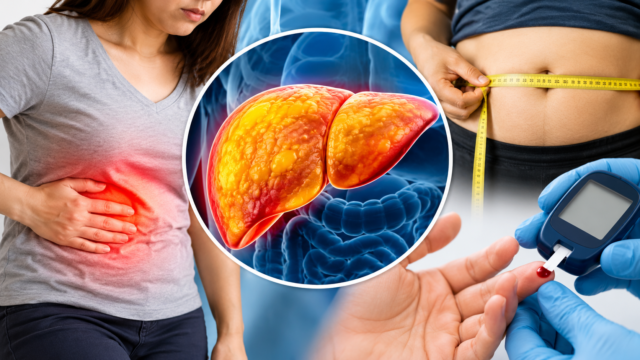 Fatty Liver Symptoms and Tests फैटी लिवर के लक्षण और जांच के बारे में जानकारी
